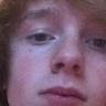 horris has no esp