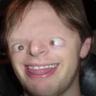 Scordis