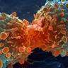 cancer strike